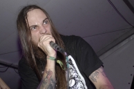 VULVODYNIA